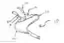 Fig. 01 - Nasal cannula