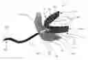 Fig. 01 - Methods and devices for relieving upper airway obstructions