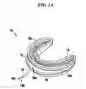 Fig. 02 - Methods and devices for relieving upper airway obstructions