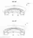 Fig. 08 - Methods and devices for relieving upper airway obstructions
