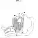 Fig. 11 - Methods and devices for relieving upper airway obstructions