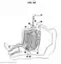 Fig. 12 - Methods and devices for relieving upper airway obstructions