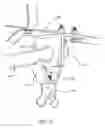 Fig. 12 - Trailer stabilizing device and method of using same