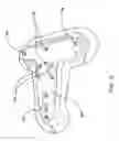 Fig. 14 - Trailer stabilizing device and method of using same