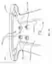 Fig. 15 - Trailer stabilizing device and method of using same