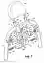 Fig. 08 - Active Head Restraint