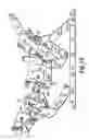 Fig. 12 - Zero clearance recliner mechanism