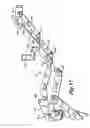 Fig. 13 - Zero clearance recliner mechanism