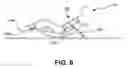 Fig. 09 - Rocker lounge