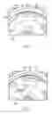 Fig. 07 - Disc recliner with memory