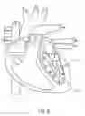 Fig. 04 - 3D-2D adaptive shape model supported motion compensated reconstruction