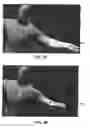 Fig. 11 - SYSTEM AND METHOD FOR INTERACTIVE MASKING AND MODIFYING OF 3D OBJECTS