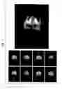 Fig. 07 - Infrared Scanner for Biological Applications