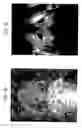 Fig. 09 - Infrared Scanner for Biological Applications