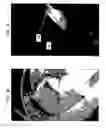 Fig. 11 - Infrared Scanner for Biological Applications