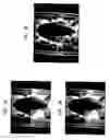 Fig. 12 - Infrared Scanner for Biological Applications