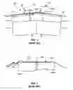 Fig. 02 - Magnetic head having three modules