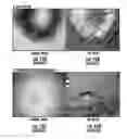 Fig. 13 - Finger sensor using polarized light and associated methods