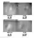 Fig. 14 - Finger sensor using polarized light and associated methods