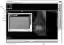 Fig. 01 - Graphical user interface for displaying a radiology image for a patient and an associated laboratory report summary