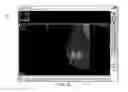 Fig. 08 - Graphical user interface for displaying a radiology image for a patient and an associated laboratory report summary