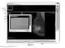 Fig. 09 - Graphical user interface for displaying a radiology image for a patient and an associated laboratory report summary