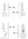 Fig. 09 - MODIFIED-OUTPUT FIBER OPTIC TIPS