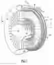 Fig. 02 - Inducer for a Fan Blade of a Tip Turbine Engine