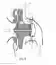 Fig. 05 - Turbine part of a turbocompressor and a method of avoiding carbon build-up in the turbine part of a turbocompressor