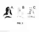 Fig. 04 - Alzheimer's Disease Imaging Agents