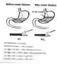 Fig. 01 - Measuring Gastrointestinal Parameters