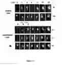 Fig. 16 - Single chain trimers and uses therefor