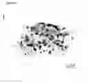 Fig. 17 - Method of deriving mesenchymal stem cells from ES cells using FGF2