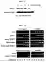 Fig. 03 - Method to Enhance the Bone Formation Activity of Bmp by Runx2 Acetylation