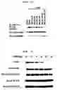 Fig. 07 - Method to Enhance the Bone Formation Activity of Bmp by Runx2 Acetylation