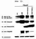 Fig. 10 - Method to Enhance the Bone Formation Activity of Bmp by Runx2 Acetylation