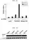 Fig. 14 - Method to Enhance the Bone Formation Activity of Bmp by Runx2 Acetylation