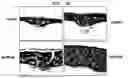 Fig. 16 - Method to Enhance the Bone Formation Activity of Bmp by Runx2 Acetylation