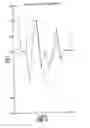 Fig. 12 - Methods of treating pervasive development disorders