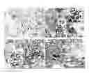 Fig. 01 - Pharmaceutical Composition Having Inhibitory Effect on Overproduction and Accumulation of Extracellular Matrix