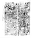 Fig. 02 - Pharmaceutical Composition Having Inhibitory Effect on Overproduction and Accumulation of Extracellular Matrix