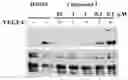 Fig. 01 - VEGFR3 INHIBITORS