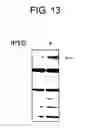 Fig. 15 - Diagnostic Kit for Solid Cancer and Medicament for Solid Cancer Therapy
