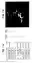 Fig. 18 - Nogo receptor-mediated blockade of axonal growth