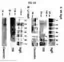 Fig. 30 - Nogo receptor-mediated blockade of axonal growth