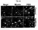 Fig. 32 - Nogo receptor-mediated blockade of axonal growth