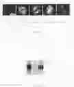 Fig. 02 - Novel Phosphorylated Phosphatase Cdc25b Sequences, Antibodies Directed Against Said Sequences and Uses Thereof