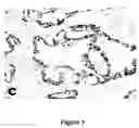Fig. 02 - Molecular Markers Associated with Bone Metastasis