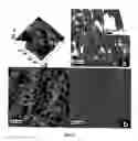 Fig. 06 - Methods for production and use of synthetic hydroxyapatite and fluorapatite nanorods, and superstructures assembled from the same