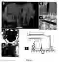 Fig. 11 - Methods for production and use of synthetic hydroxyapatite and fluorapatite nanorods, and superstructures assembled from the same